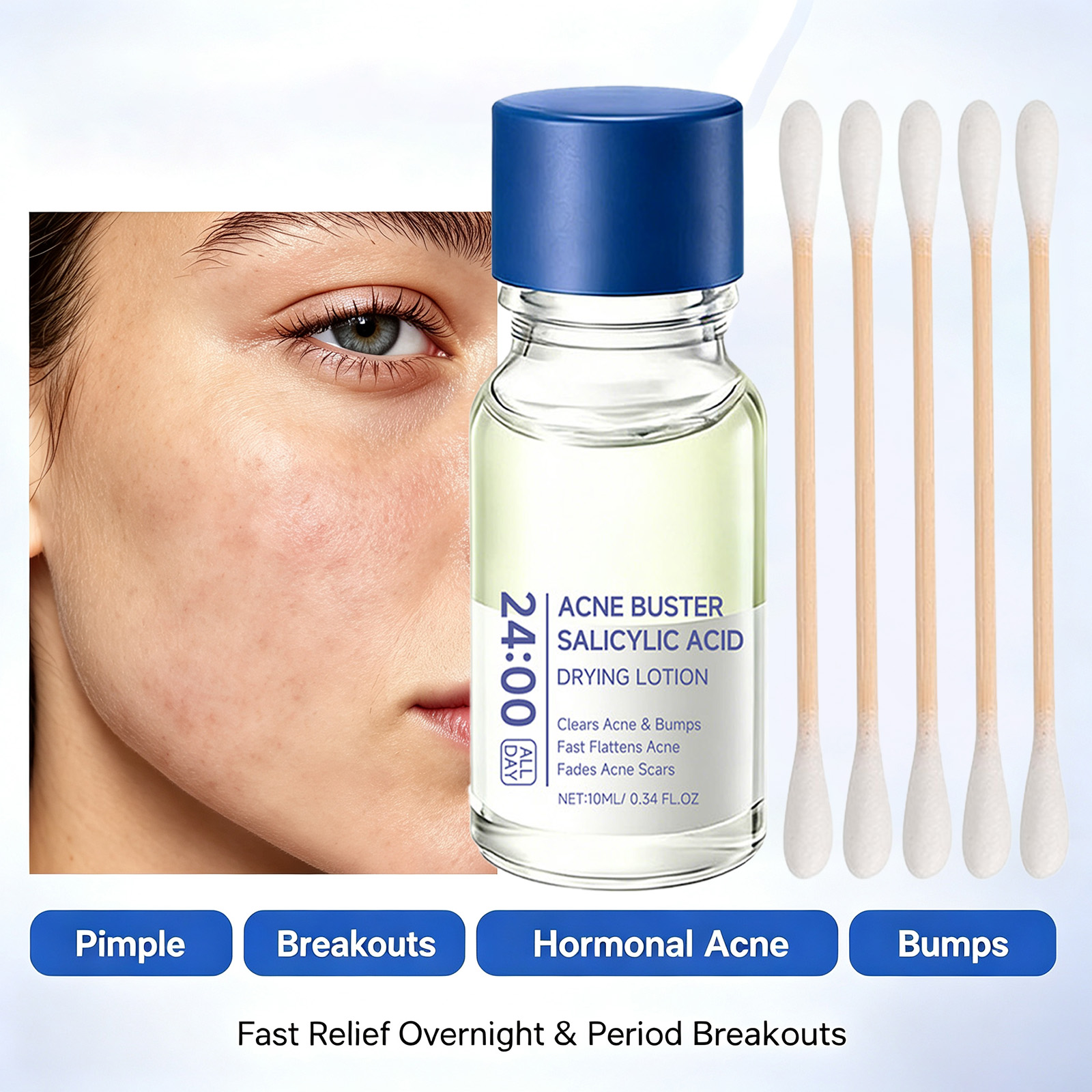 Tranexamic Acid Serum - Suero Corrector de Manchas con Ácido