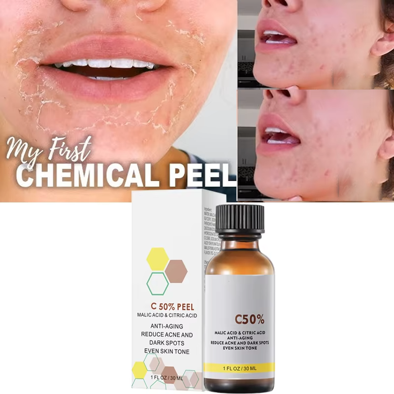 Tranexamic Acid Serum - Con ácido málico y ácido cítrico
