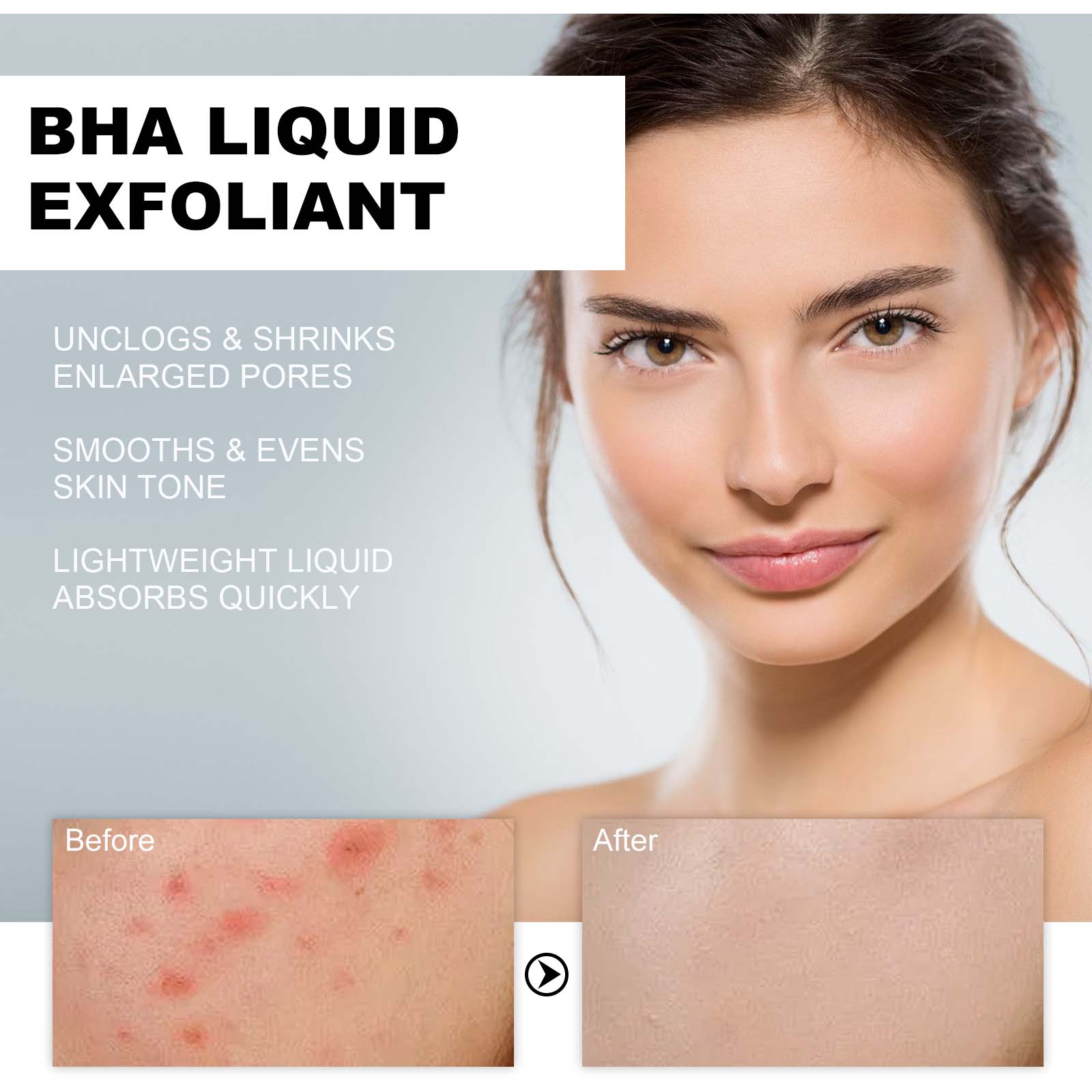 Suero Exfoliante Líquido con 2 - Tranexamic Acid Serum reseña y precio