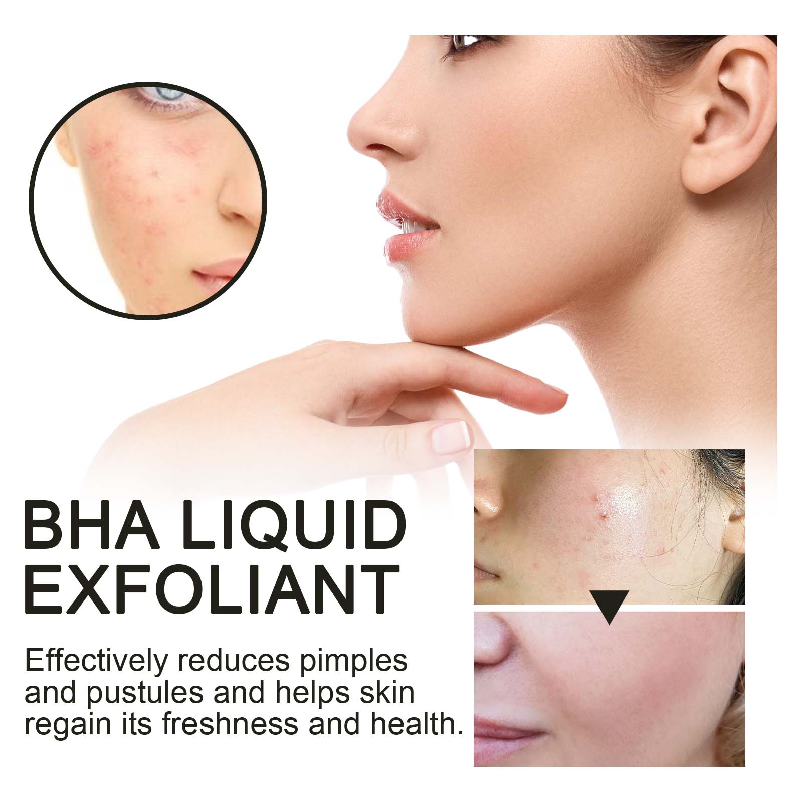 Suero Exfoliante Líquido con 2 - Tranexamic Acid Serum reseña y precio