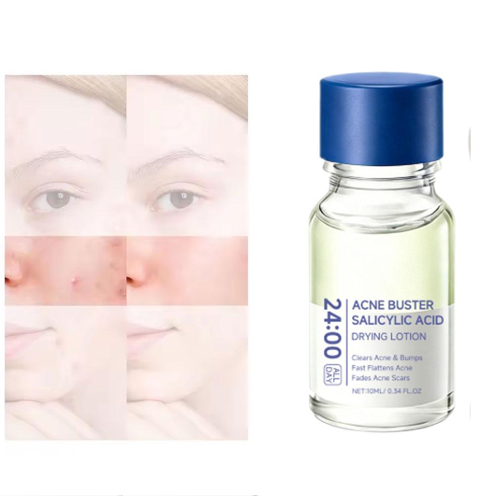 Loción de Tratamiento con Ácid - Tranexamic Acid Serum reseña y precio