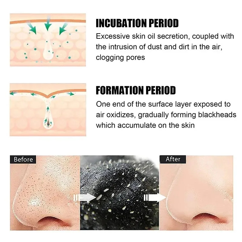 10/150PCS Mascarilla para Elim - Skincare Indonesia reseña y precio