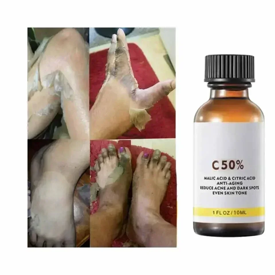 Con ácido málico y ácido cítri - Tranexamic Acid Serum reseña y precio