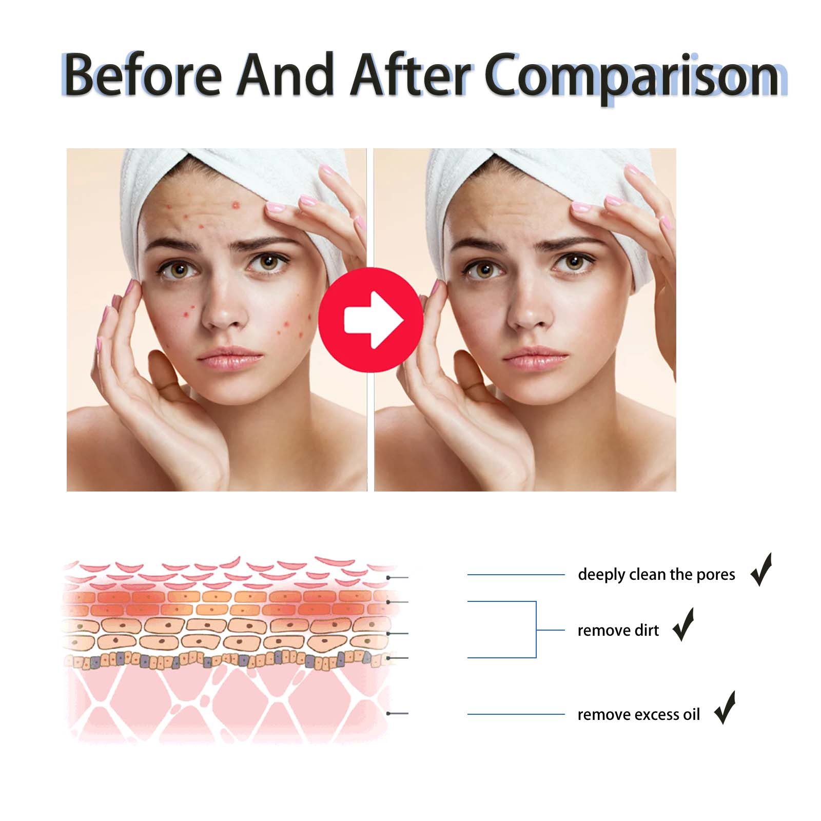 Suero Exfoliante Líquido con 2 - Tranexamic Acid Serum reseña y precio